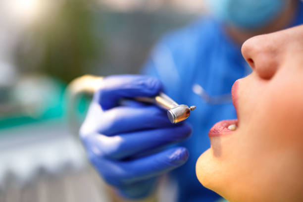 Dental Inlays and Onlays in Gloversville, NY